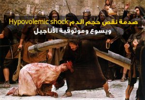 صدمة نقص حجم الدم Hypovolemic shock ويسوع وموثوقية الأناجيل